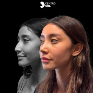 464567616_18019512980544293_3787657521921099345_n