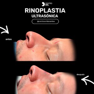 579604279_18060000308544293_2630150398885802126_n