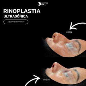 581553582_18060444524544293_9120630340677718292_n