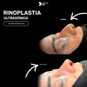 584899590_18060709262544293_8756437714761671228_n